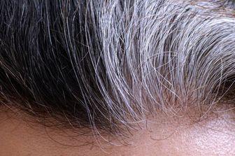 سفید شدن موها، چه نکاتی را در مورد سلامتی تان آشکار می سازند؟ 